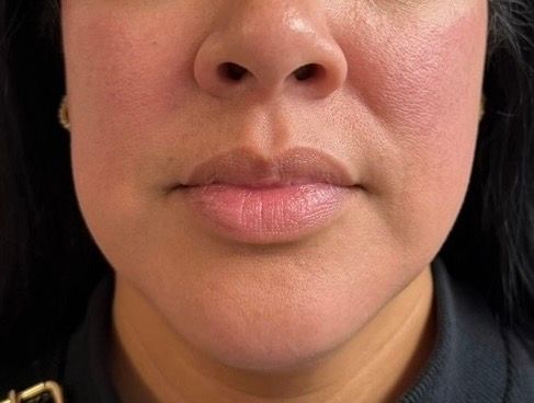Close-up of a neutral expression on a person’s lower face and nose against a dark background