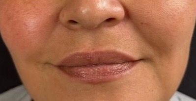 Close-up of a person’s lower face with a neutral expression and closed lips.
