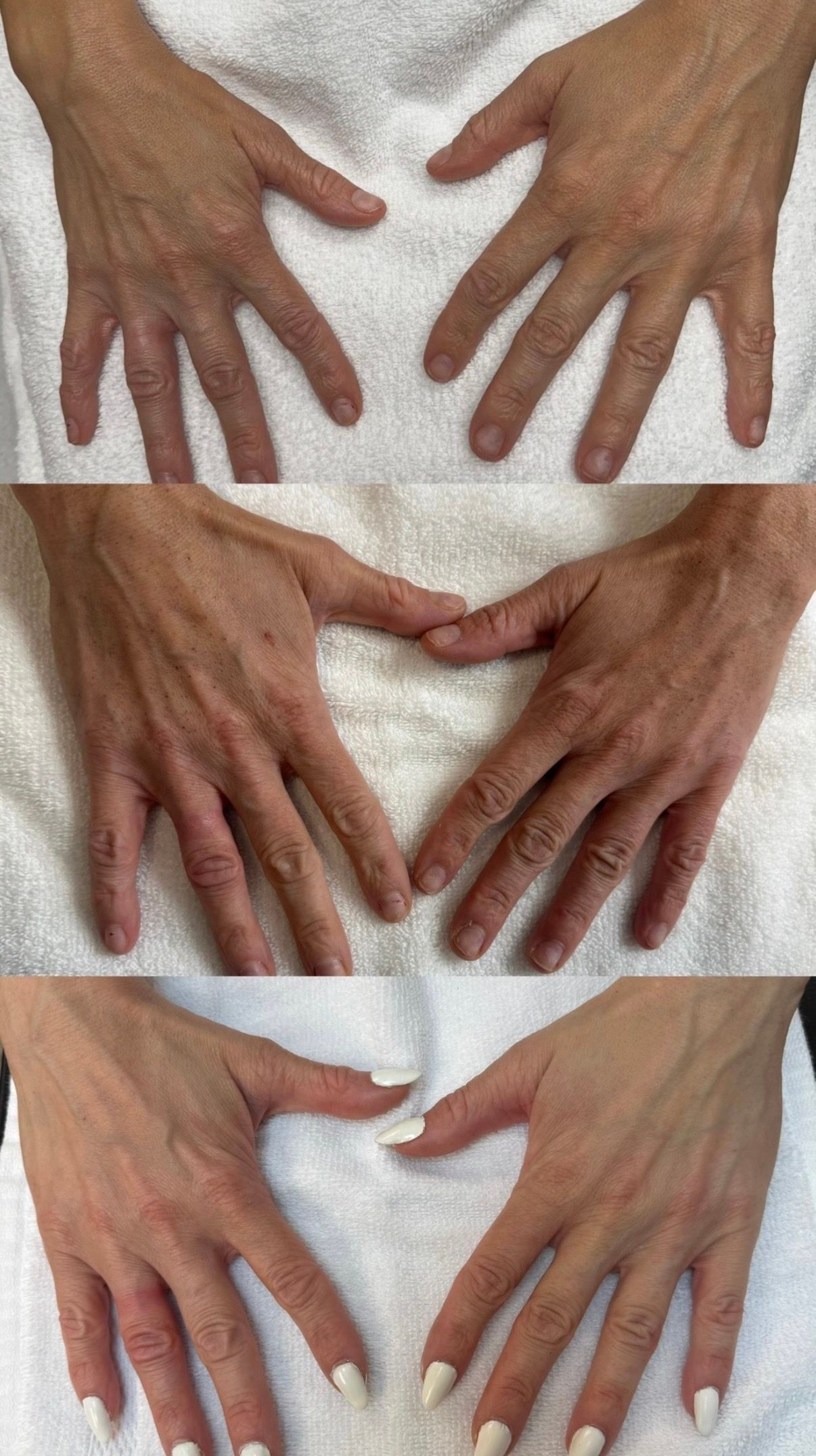 Three views of hands resting on a white towel, showing different finger positions.