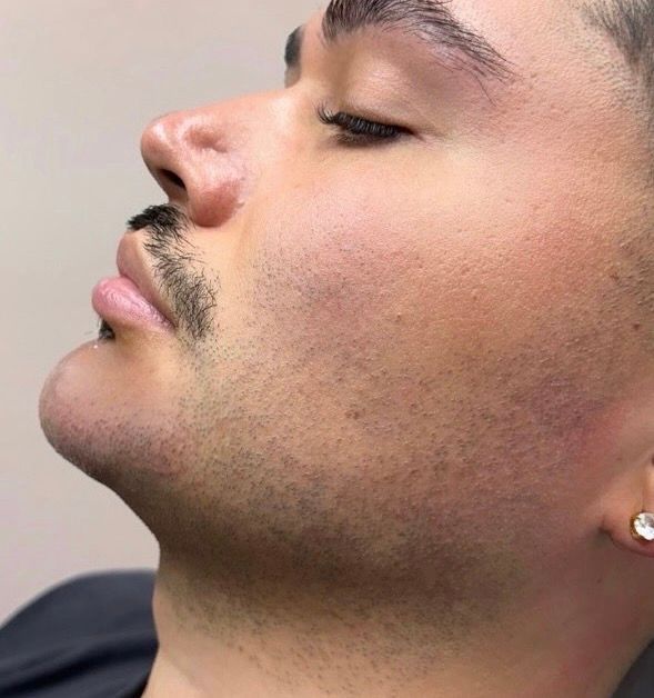 Side-profile close-up of a person with a mustache, wearing a stud earring, eyes closed.