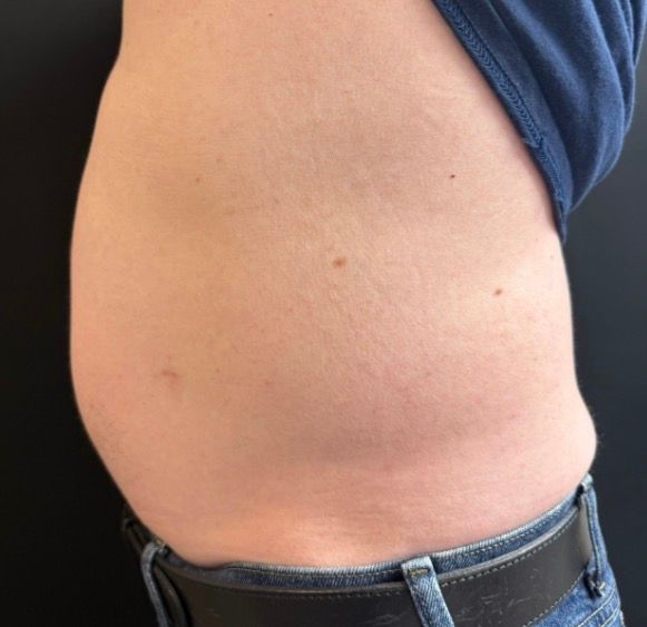 Side view of a bare abdomen above blue jeans and a dark blue shirt