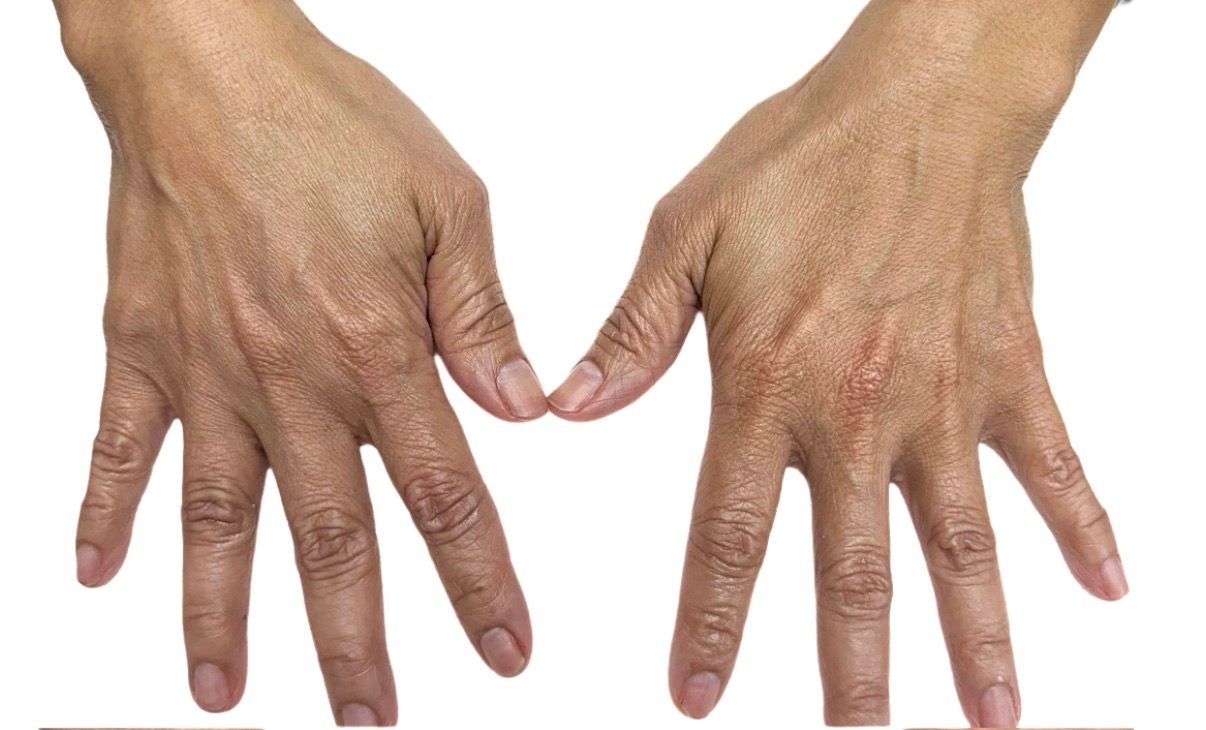 Two hands with fingers spread, forming a heart shape with the thumbs and index fingers