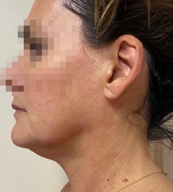 Side-profile close-up of a woman’s face with blurred eyes and a visible jawline against a plain background