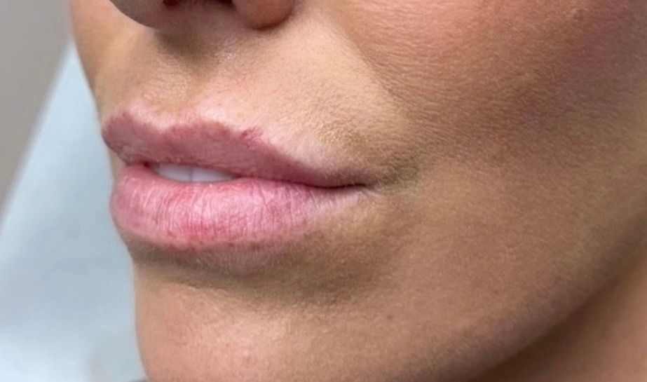 Close-up of a person’s lips and cheek with natural pink lipstick and pearl earrings