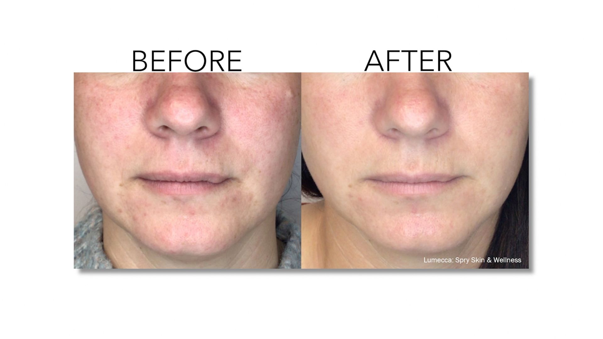 A before and after photo of a woman 's face.