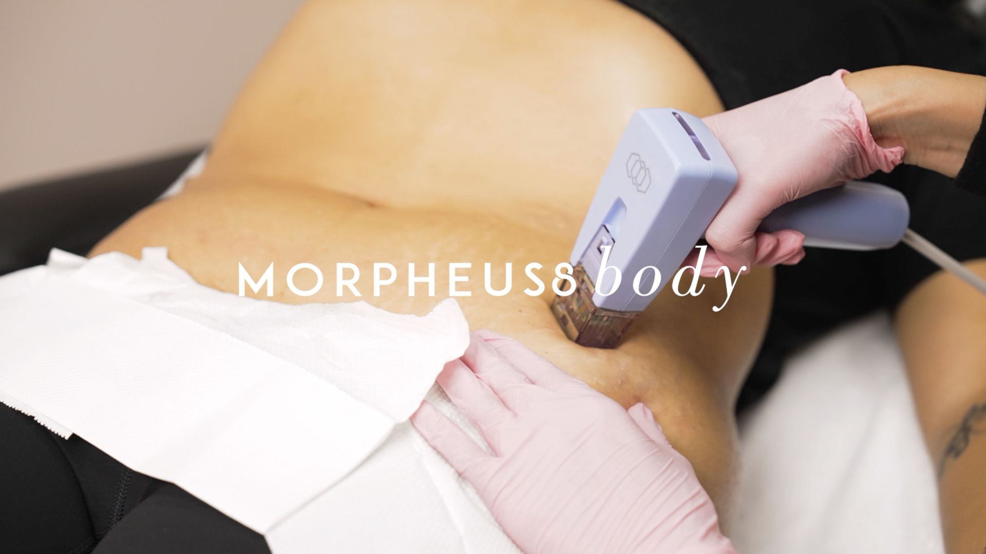 A woman is getting a laser treatment on her back.