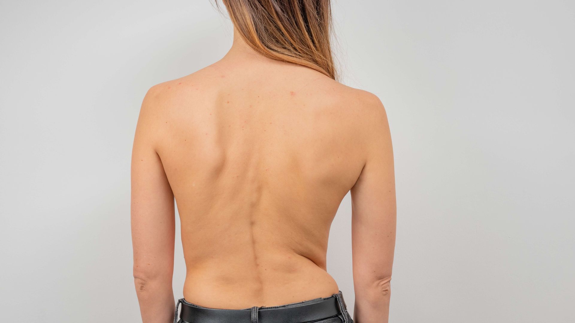 The back of a woman without a shirt is shown.