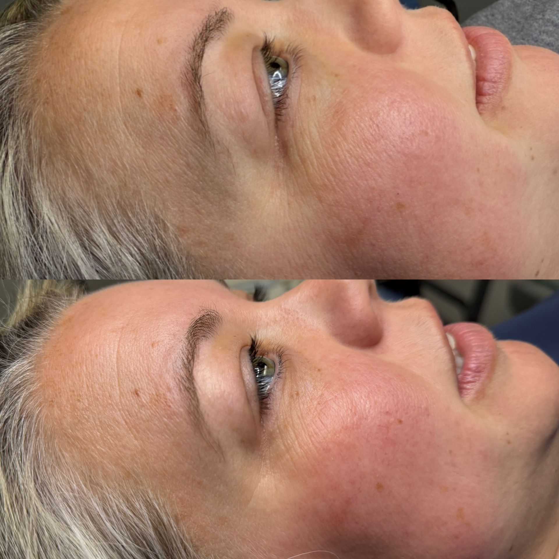 Before and after photos of a woman's face. The top photo shows less prominent blush and brow definition than the bottom.