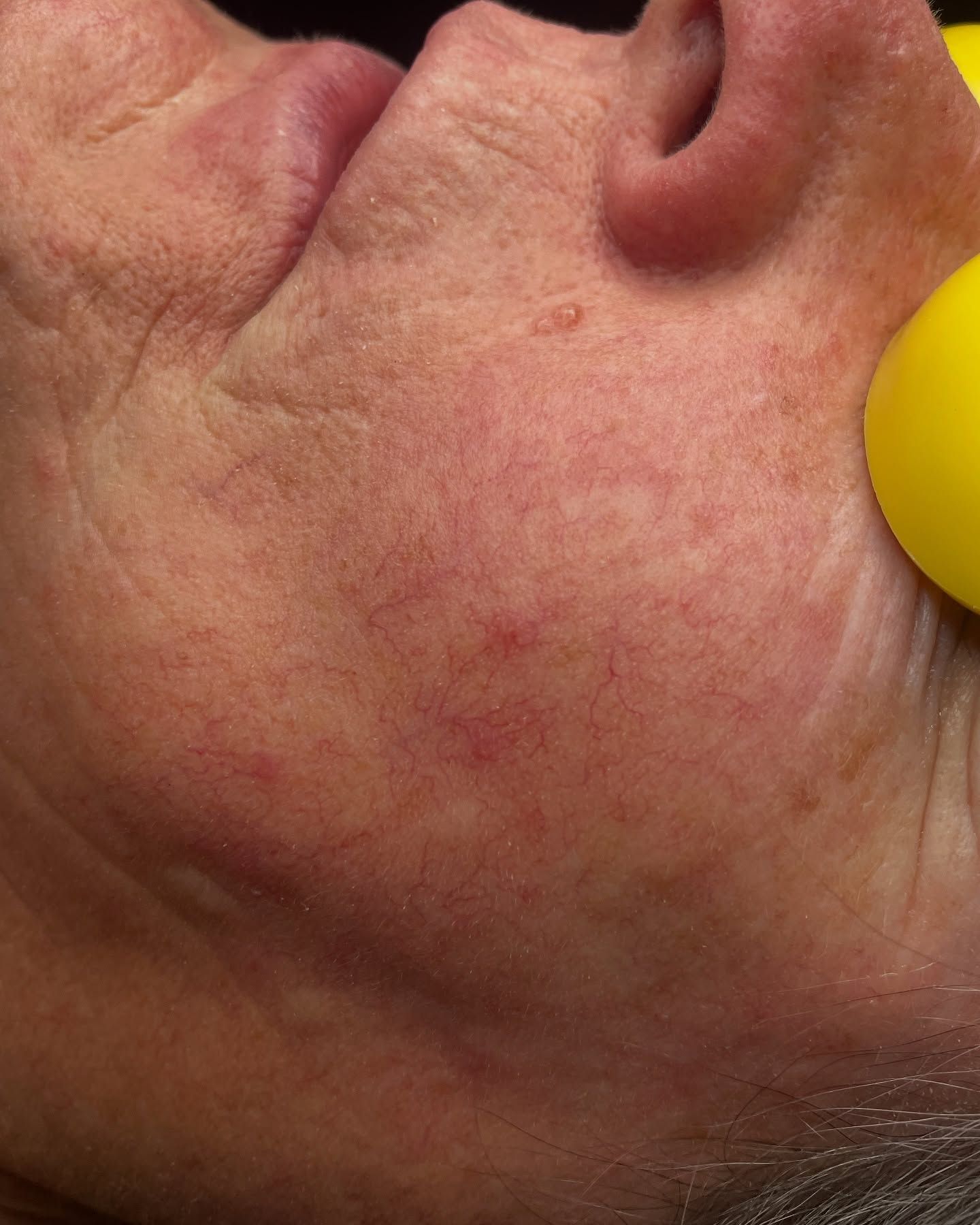 A large house with a lot of windows and a garage on a rainy day.