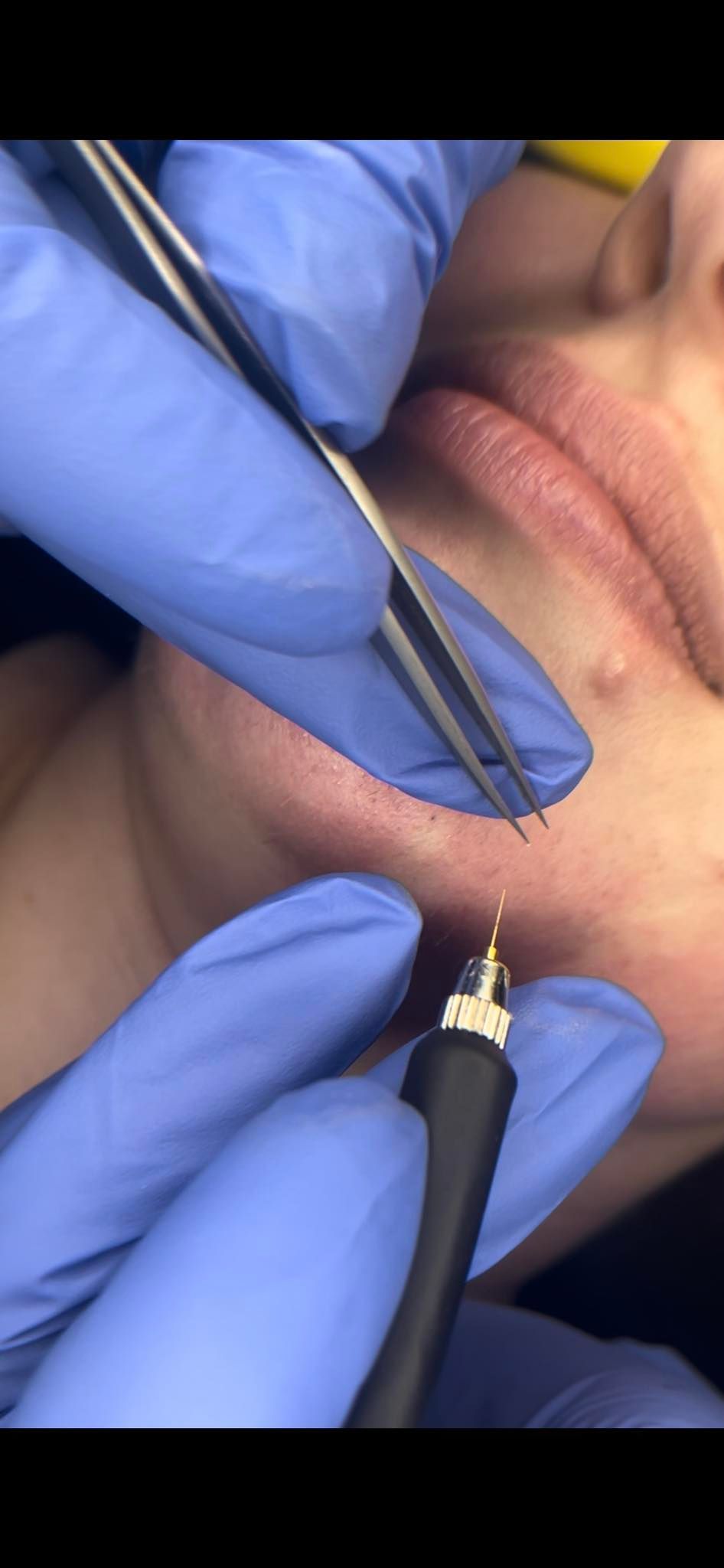 A large house with a lot of windows and a garage on a rainy day.