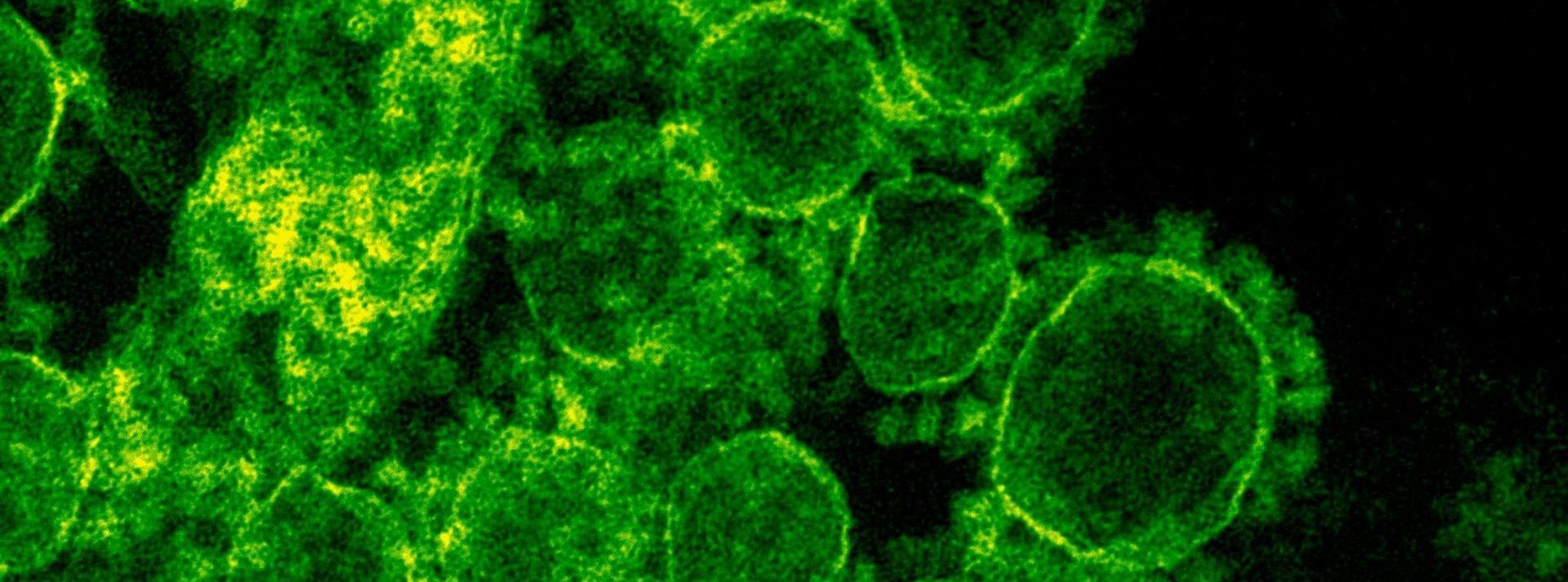 What is in roof spray?