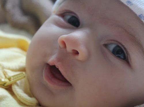 Baby with open mouth, looking up; wearing yellow and a white hat.