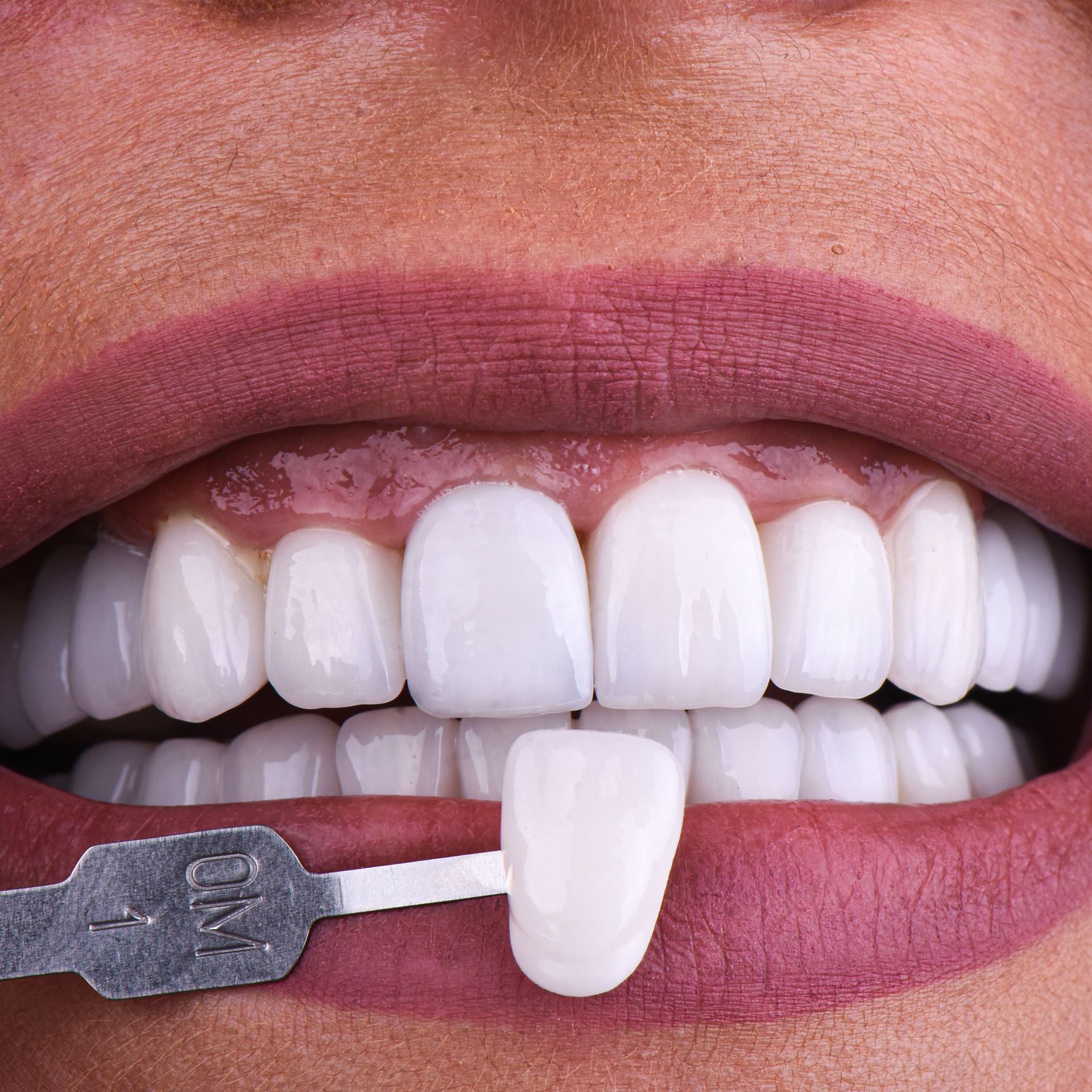 Close-up of a person's mouth with a tooth shade guide comparing it to their bright, white teeth.
