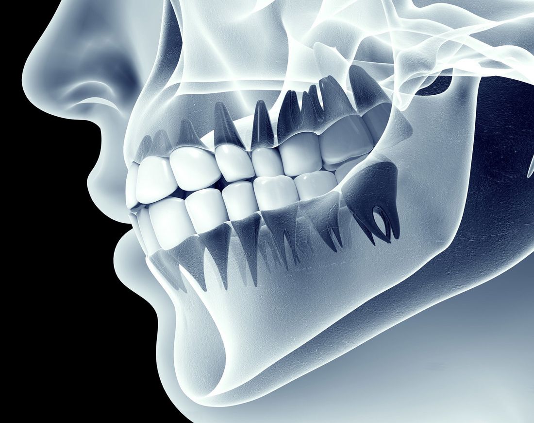 ortodonzia infantile