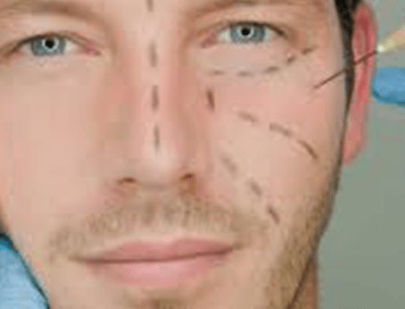 médico cirujano plástico