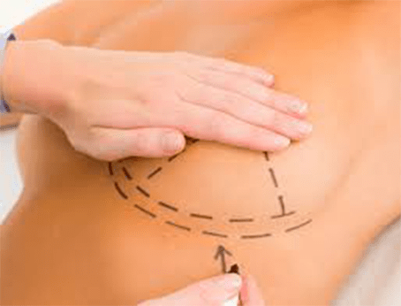 médico cirujano plástico