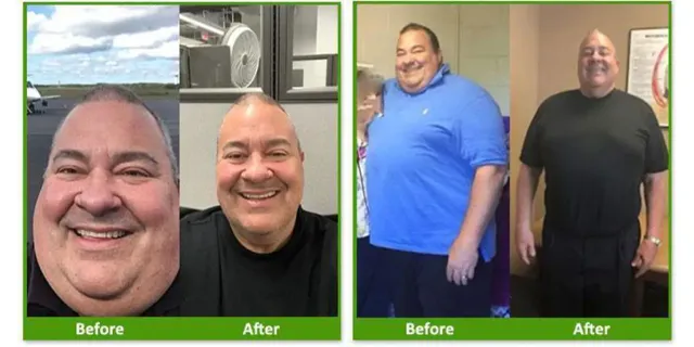 Before & After Testimonials | Nova Physician Wellness Center