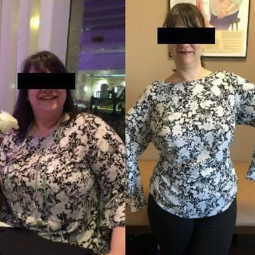 Side-by-side before-and-after full-body photos of a person in a floral top and black pants indoors.