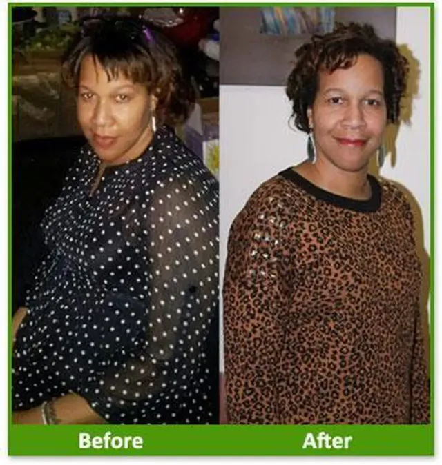 Before & After Testimonials | Nova Physician Wellness Center