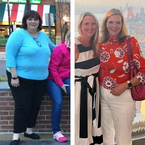 Two side-by-side photos of a woman before and after weight loss, wearing different outfits.