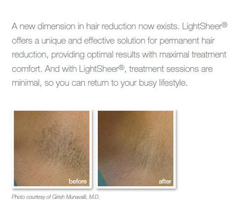 lightsheer hair reduction information
