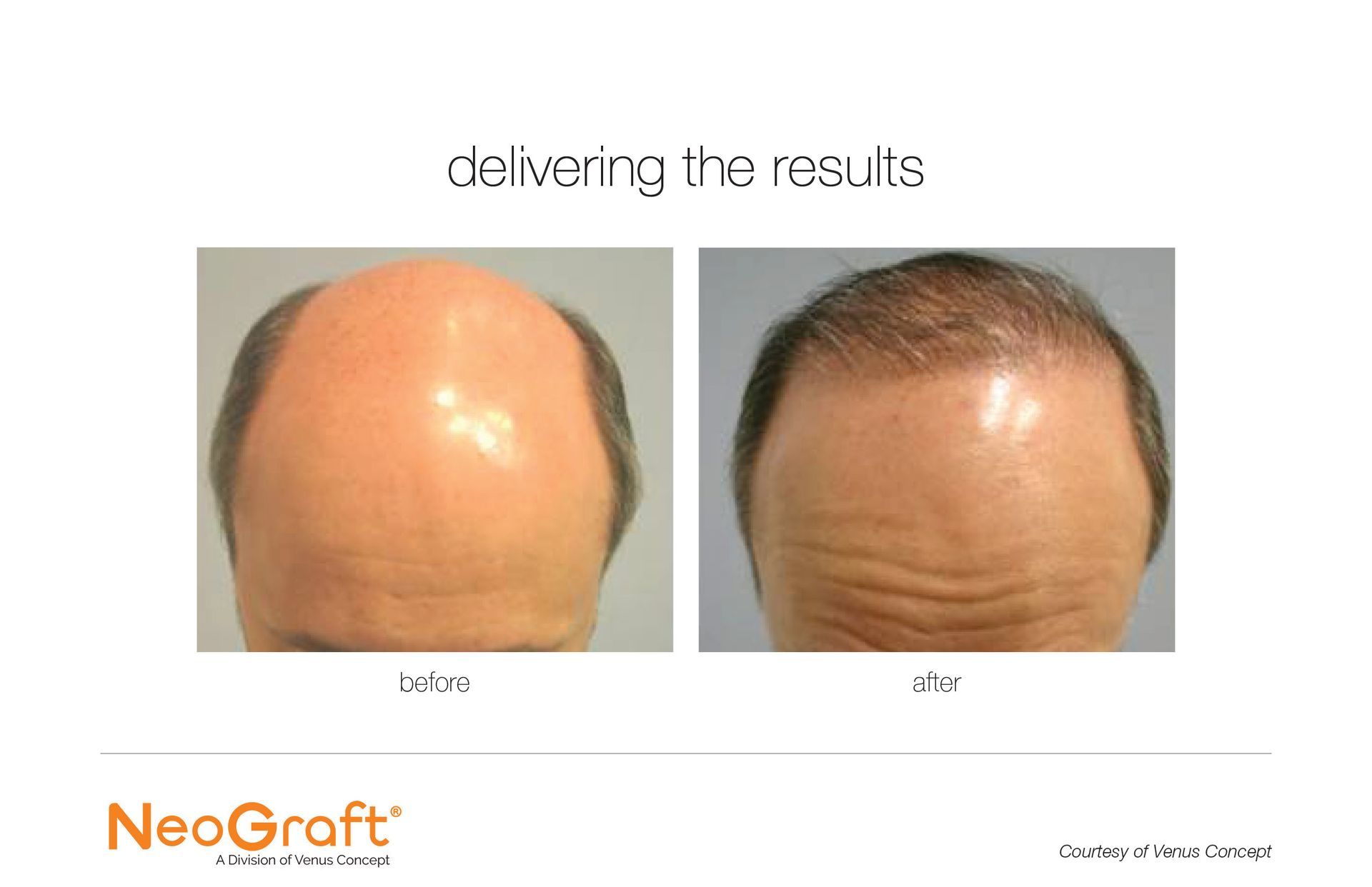 cosmetic procedures