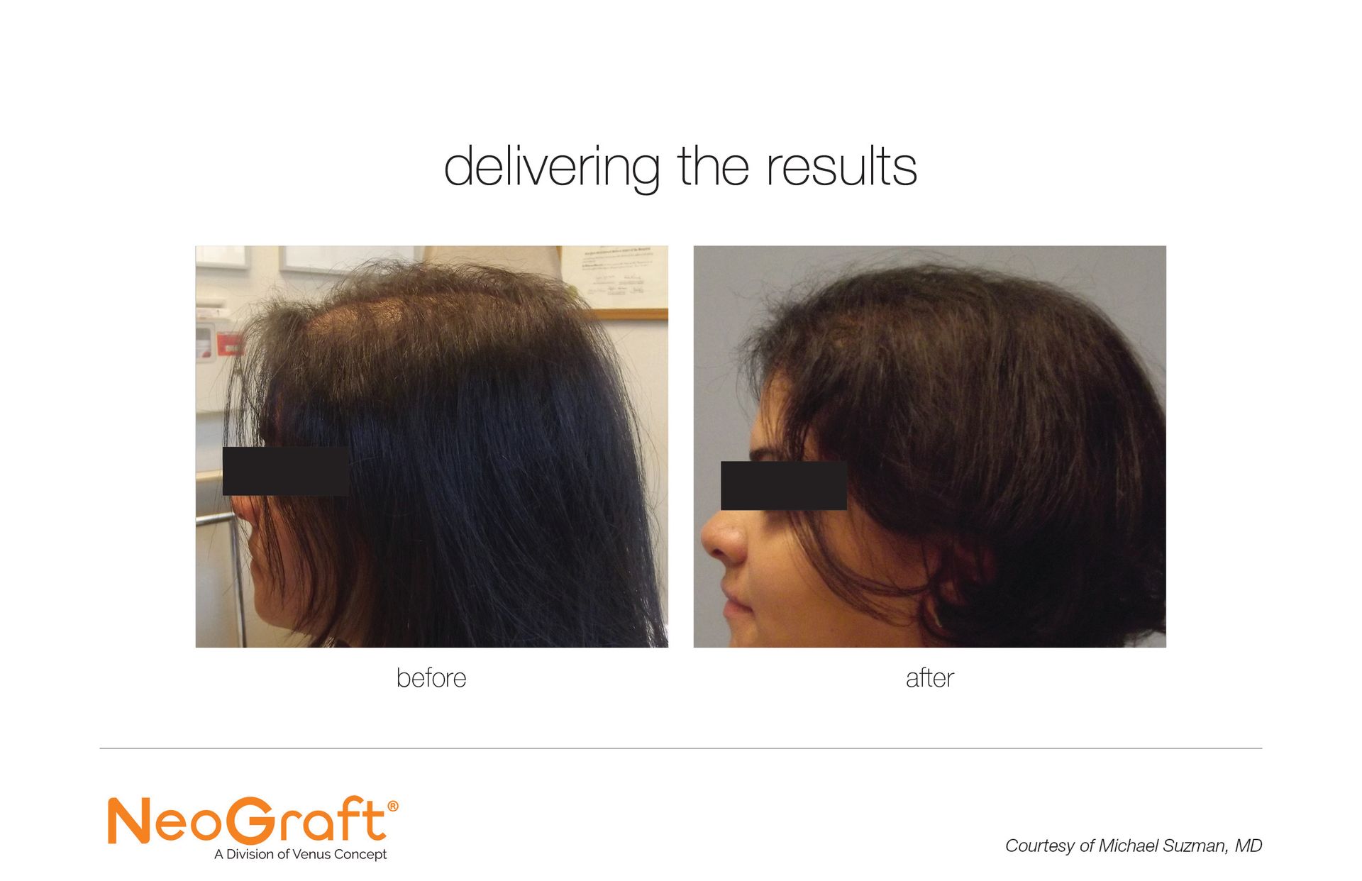 A before and after picture of a woman 's hair