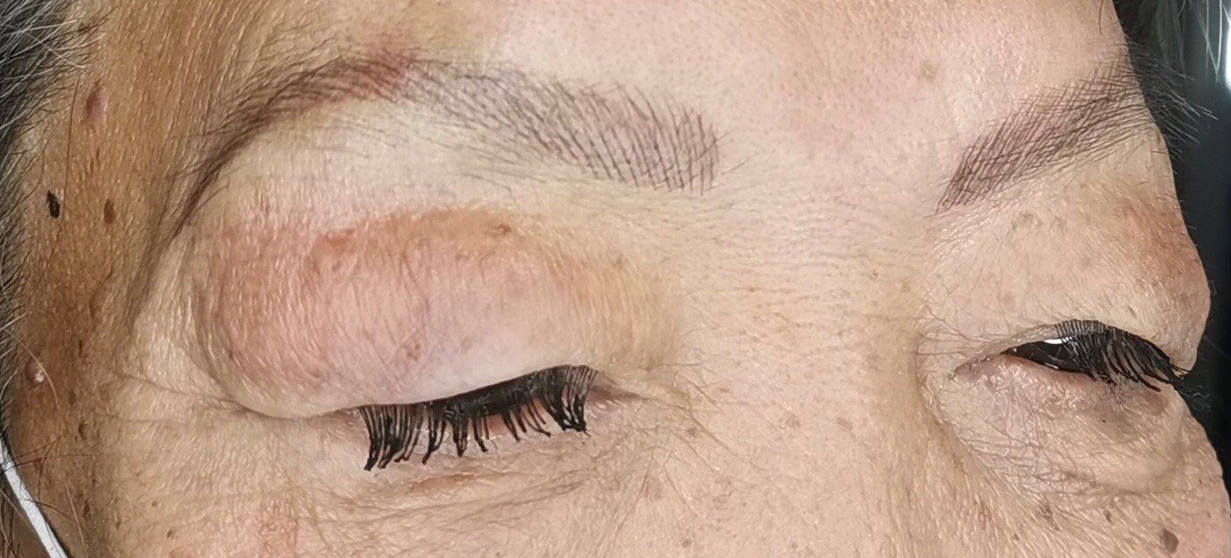 after semi-permanent eyebrows