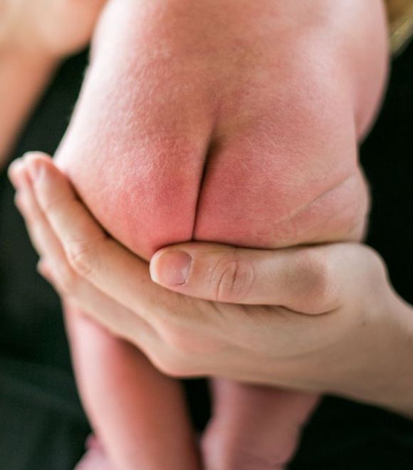 NEOLO olio di cura intima, olio vaginale, emorroidi prurito e bruciore, micosi da pannolino, candidosi, micosi vaginale, infezioni vaginali, vaginosi Gardnerella, menopausa, gravidanza, prurito, bruciore, dolore zona intima, dermatite da pannolino