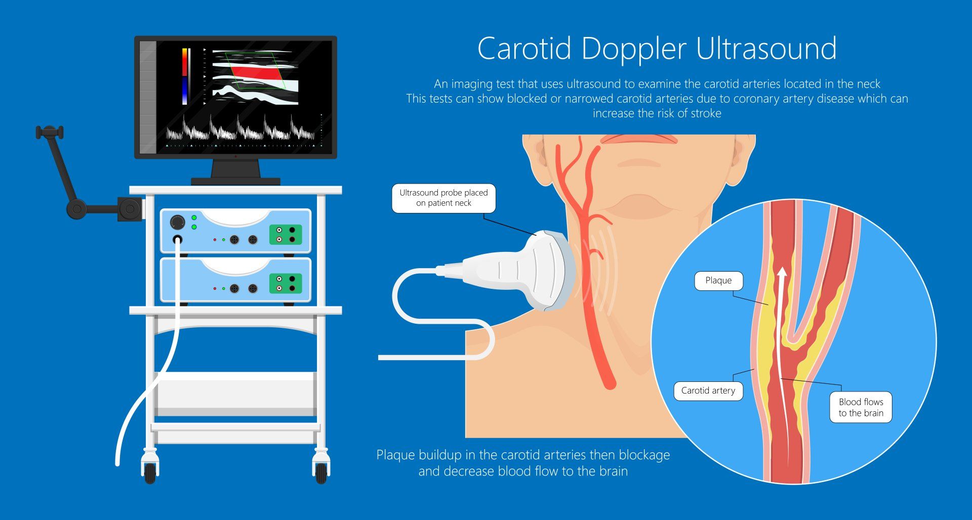 A person is getting an ultrasound of their neck.