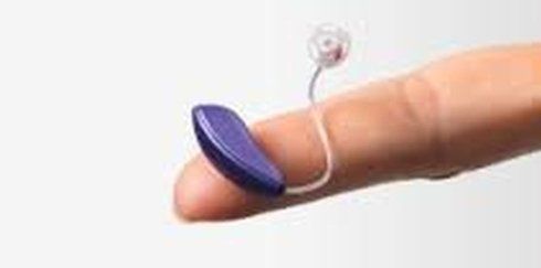 Realizzazione di protesi acustiche su misura