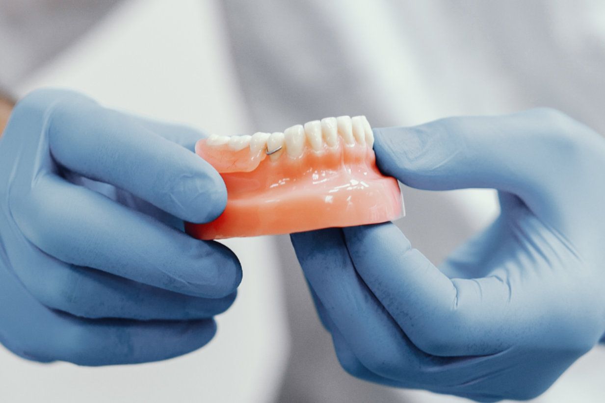 Manos con guantes azules sosteniendo una dentadura postiza.