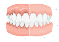 Comparación de blanqueamiento dental: el lado izquierdo tiene dientes y encías manchadas, el lado derecho tiene dientes blancos brillantes y encías rosadas.