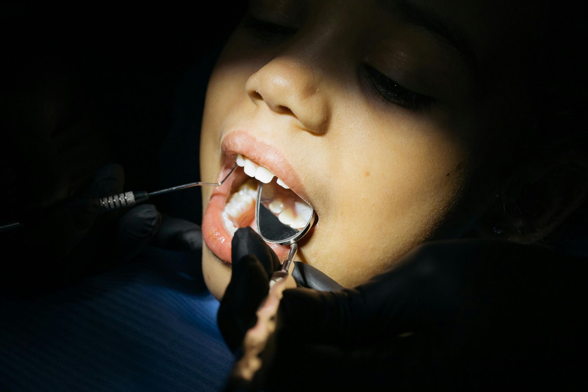 Niño recibiendo examen dental; herramientas del dentista en la boca, mostrando los dientes.