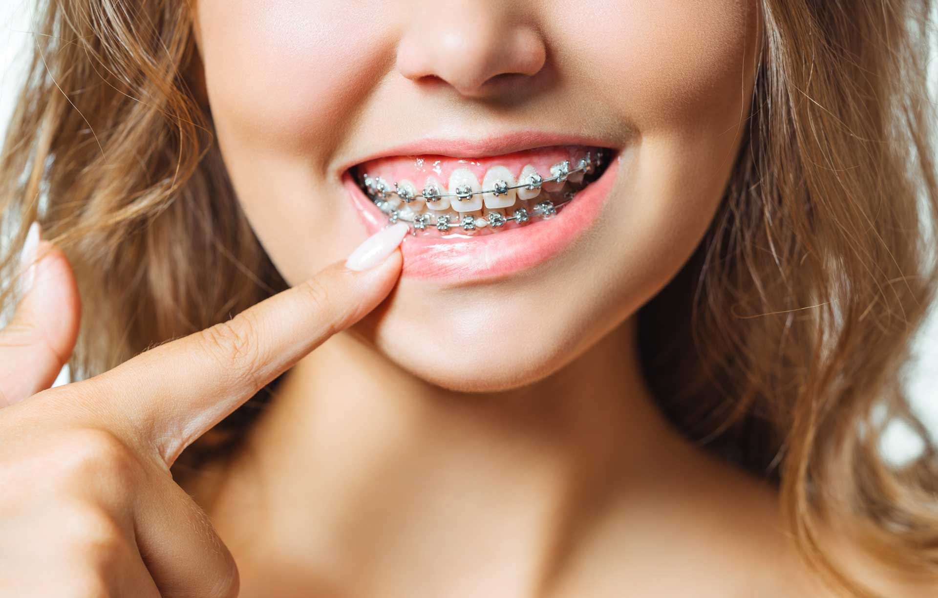 Orthodontics — Box Hill, VIC — Chong Dental