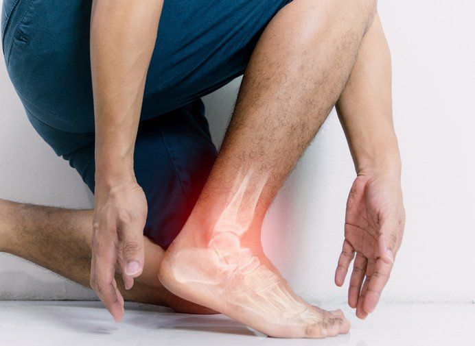 Inflammation bone ankle of humans with inflammation