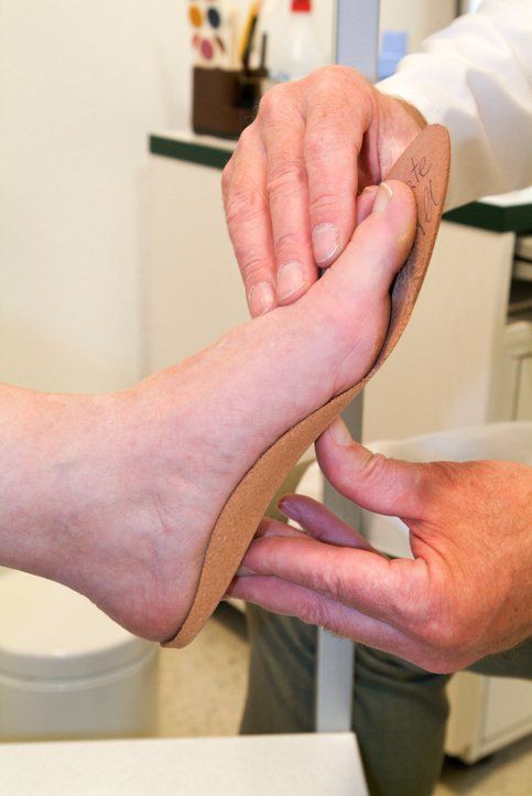 A foot being measured for orthopedic insoles by a doctor