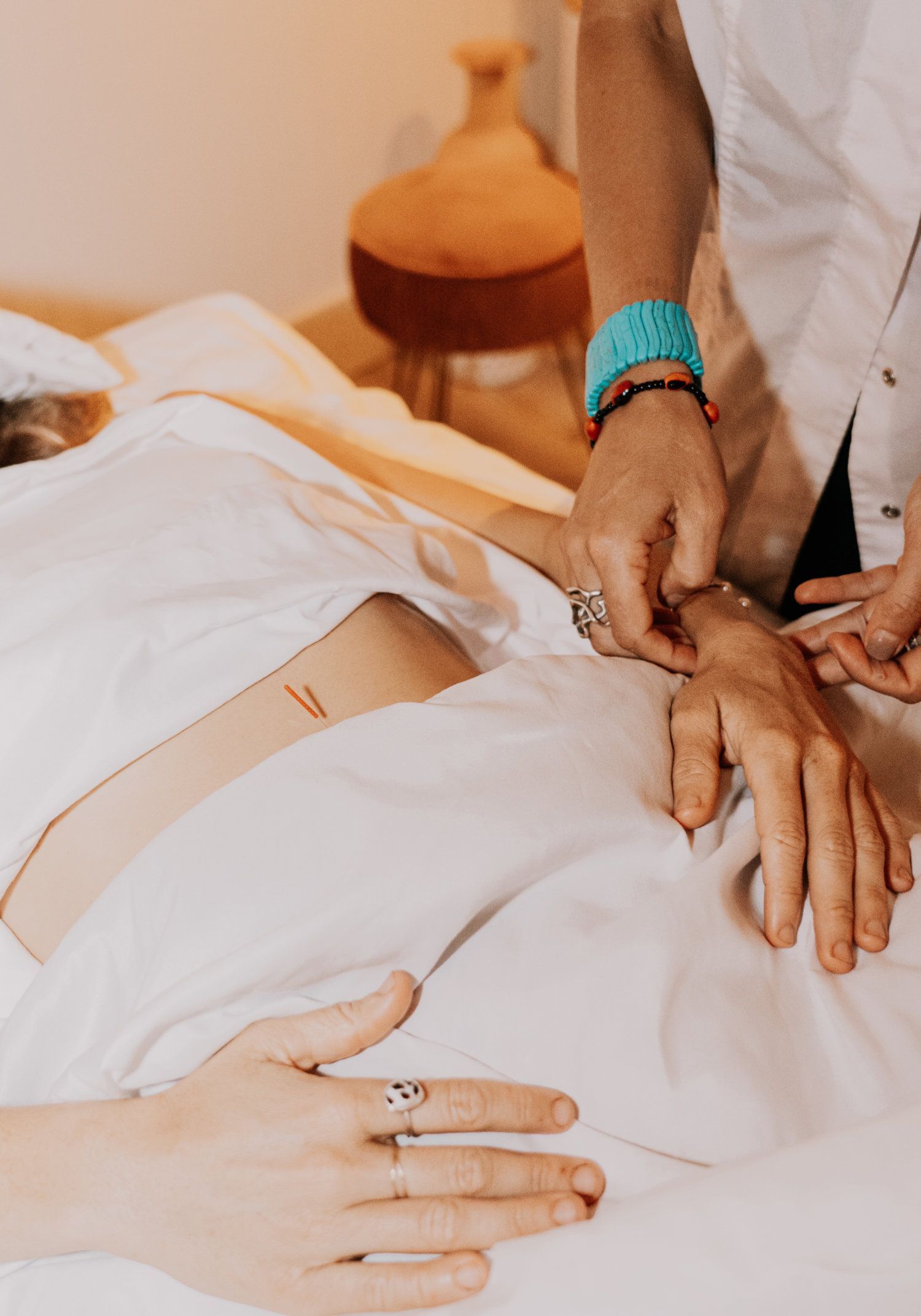 Acupuncture