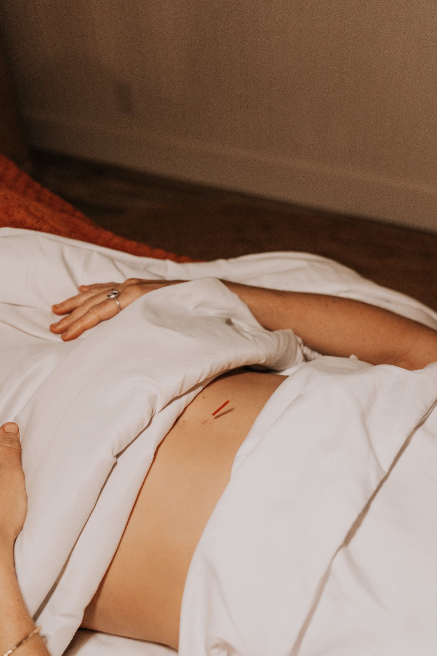 Person lying on white sheets with acupuncture needles in abdomen.