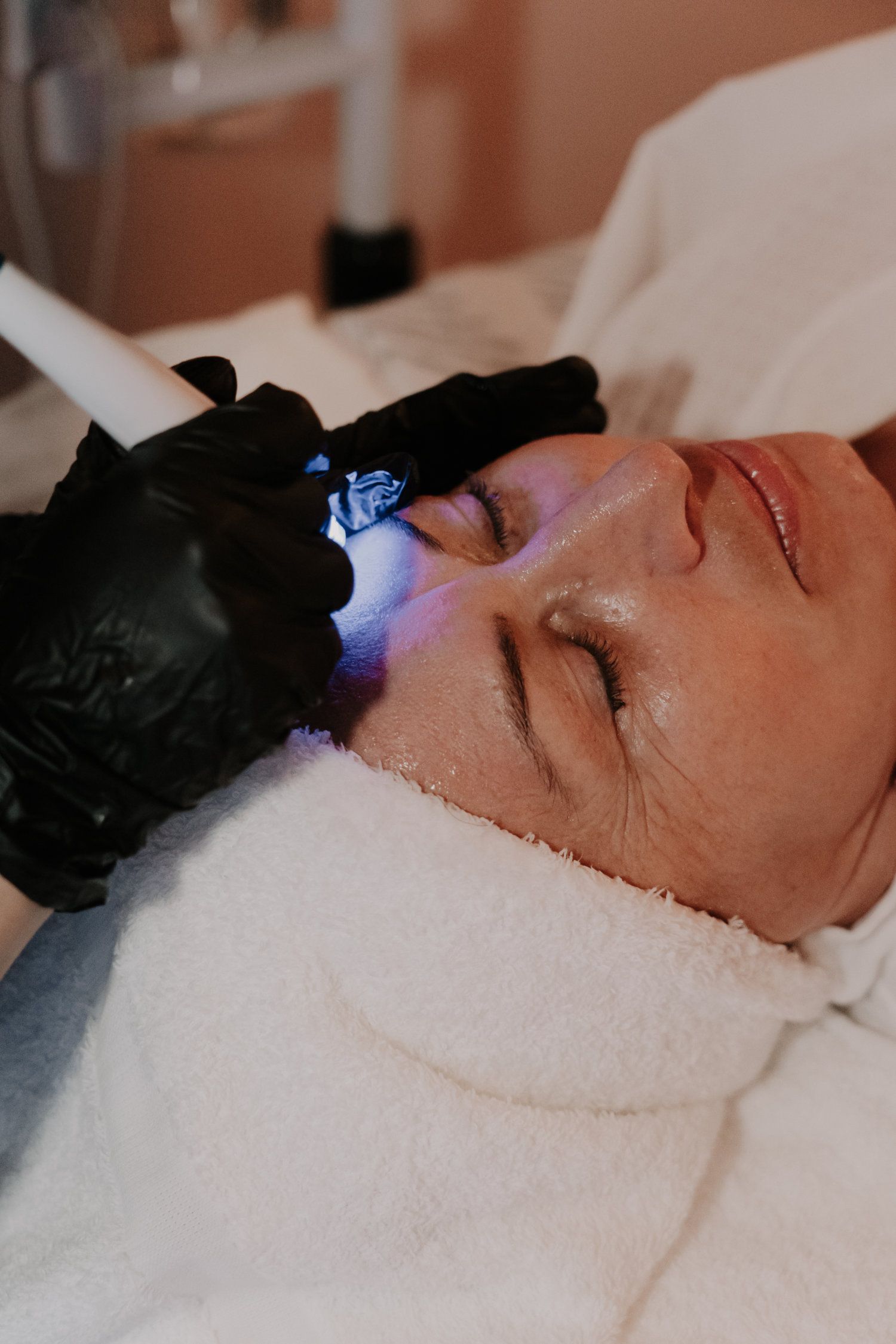 Person receiving facial treatment; gloved hand uses device near eye.