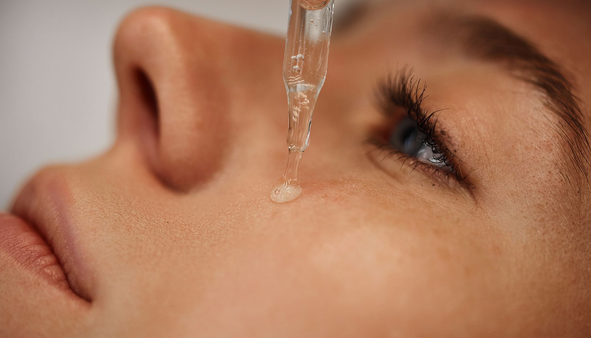 Dropper dispensing liquid onto a person's cheek near their eye. Skin close-up.
