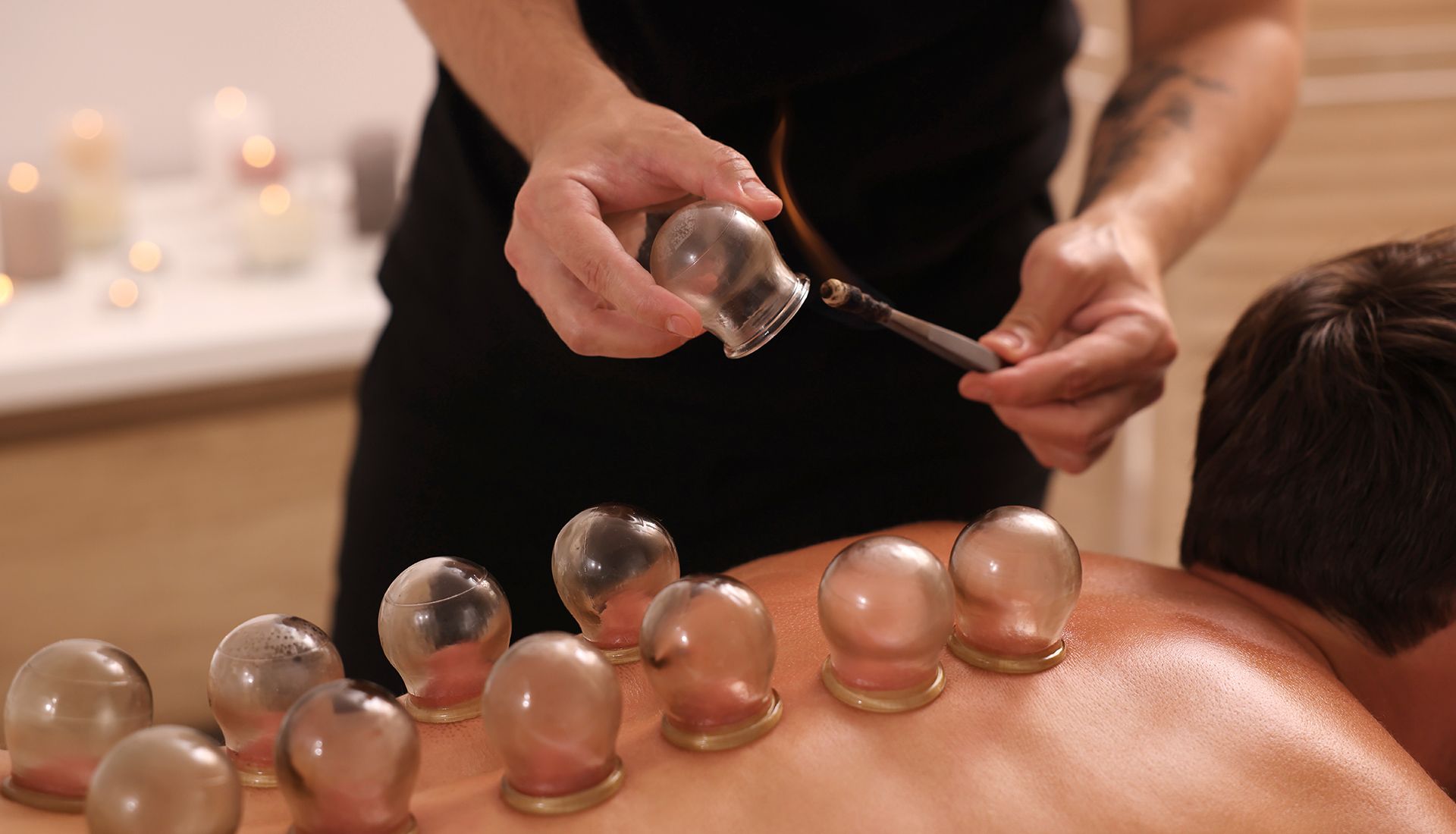 Person receiving cupping therapy on their back, therapist applying a cup.