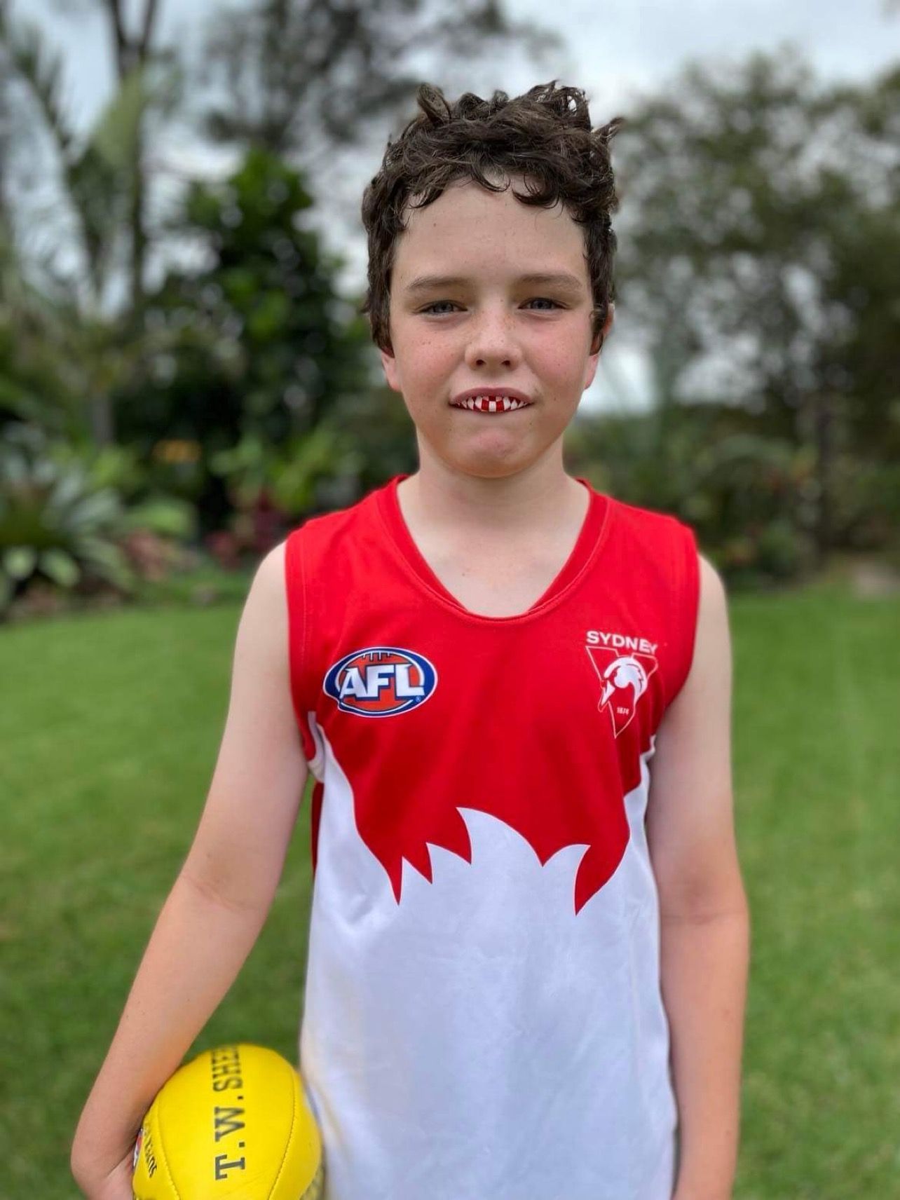 Woman Holding Mouth Guard — Central Coast, NSW — Peninsula Denture Centre