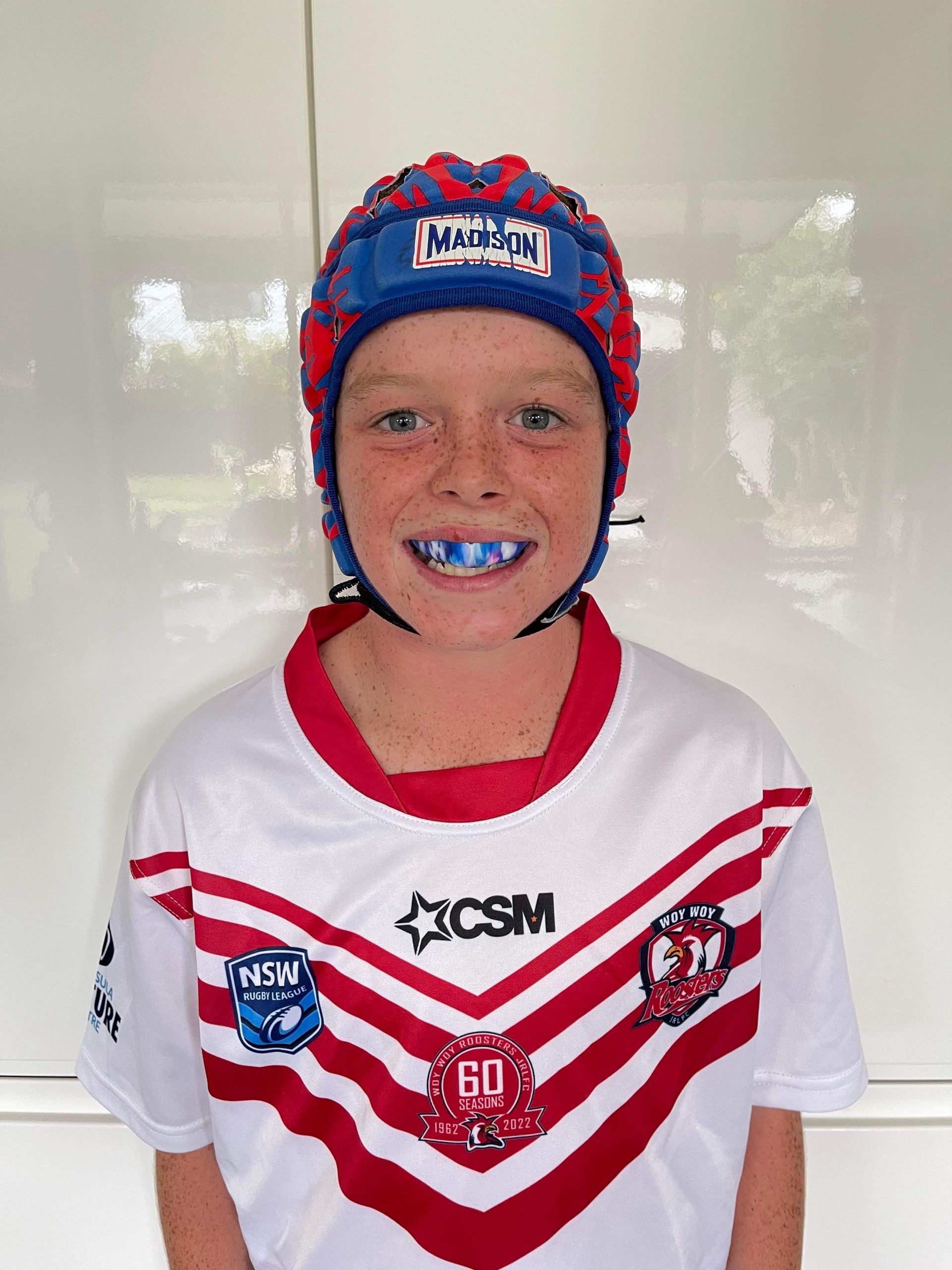 Mouth Guard — Central Coast, NSW — Peninsula Denture Centre