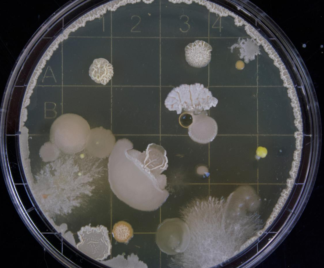 Petri dish with various bacterial colonies, white, yellow, and beige, growing on agar.