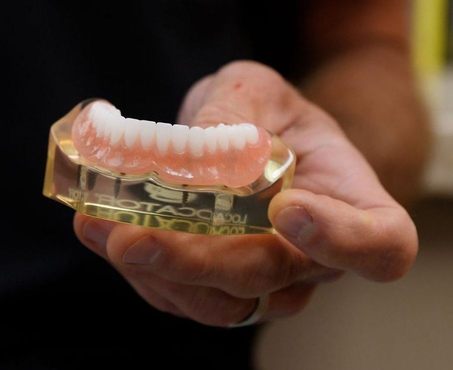 denture sample | Best family dentist for dentures and veneers in Lynnwood WA