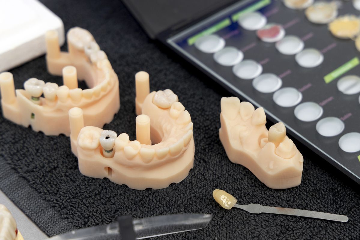 3D-printed dental models and tools on a work surface with a color swatch tablet nearby