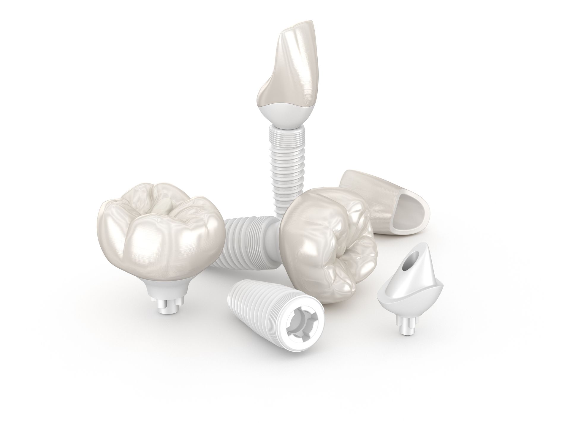 example of loose dental implants | Family dentist in lynnwood wa