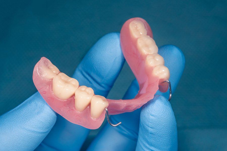 Upper Jaw Denture — Louisville, OH — Louisville Dental Clinic