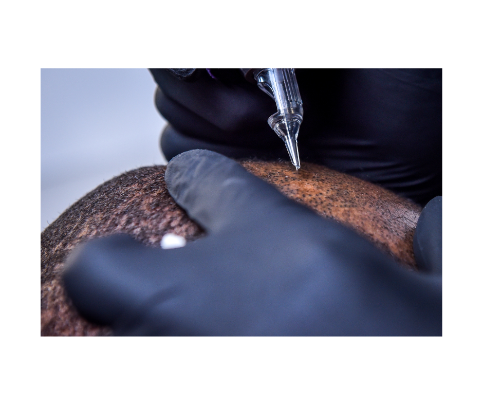 a person is getting a tattoo on their head .